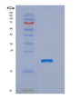 SDS-PAGE analysis of Human NTS (Neurotensin/Neuromedin N) - Recombinant Protein, showing >85% purity under 15% SDS-PAGE (Reduced)