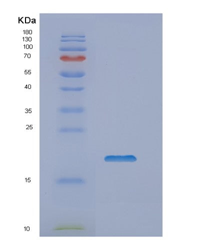 SDS-PAGE analysis of Human NUDCD2 (Nudc Domain-Containing Protein 2) - Recombinant Protein, showing >90% purity under 15% SDS-PAGE (Reduced)