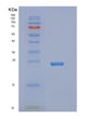 SDS-PAGE analysis of Human NUDT16 (U8 Snorna-Decapping Enzyme) - Recombinant Protein, showing >85% purity under 15% SDS-PAGE (Reduced)