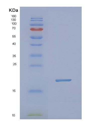 SDS-PAGE analysis of Human NXT1 (Ntf2-Related Export Protein 1) - Recombinant Protein, showing >85% purity under 15% SDS-PAGE (Reduced)