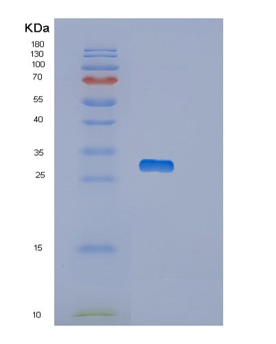 SDS-PAGE analysis of Human OTUB2 (Ubiquitin Thioesterase Otub2) - Recombinant Protein, showing >85% purity under 15% SDS-PAGE (Reduced)