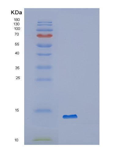 SDS-PAGE analysis of Human OXLD1 (Oxidoreductase-Like Domain-Containing Protein 1) - Recombinant Protein, showing >85% purity under 15% SDS-PAGE (Reduced)