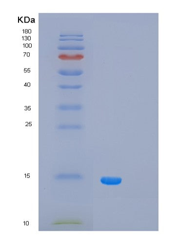 SDS-PAGE analysis of Human PCBD1 (Pterin-4-Alpha-Carbinolamine Dehydratase) - Recombinant Protein, showing >85% purity under 15% SDS-PAGE (Reduced)