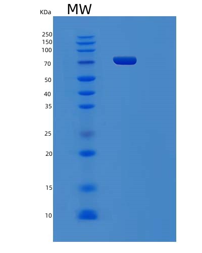SDS-PAGE analysis of Human PCDHGC4 (Protocadherin Gamma-C4) - Recombinant Protein, showing >90% purity under 15% SDS-PAGE (Reduced)