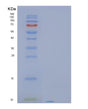SDS-PAGE analysis of Human PCP4L1 (Purkinje Cell Protein 4-Like Protein 1) - Recombinant Protein, showing >95% purity under 15% SDS-PAGE (Reduced)