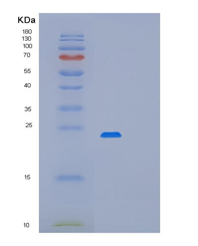 SDS-PAGE analysis of Human PDCD6 (Programmed Cell Death Protein 6) - Recombinant Protein, showing >90% purity under 15% SDS-PAGE (Reduced)