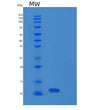 SDS-PAGE analysis of Human PDE6H (Retinal Cone Rhodopsin-Sensitive Cgmp 3',5'-Cyclic Phosphodiesterase Subunit Gamma) - Recombinant Protein, showing >85% purity under 15% SDS-PAGE (Reduced)