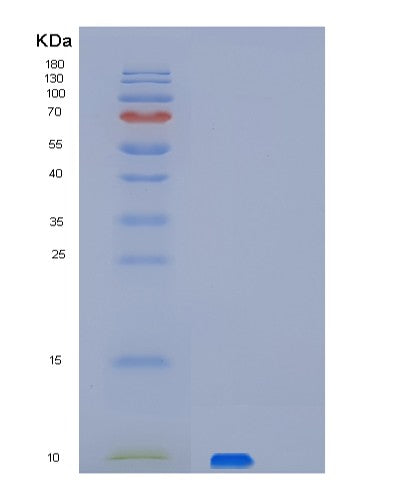 SDS-PAGE analysis of Human PET117 (Protein Pet117 Homolog, Mitochondrial) - Recombinant Protein, showing >95% purity under 15% SDS-PAGE (Reduced)