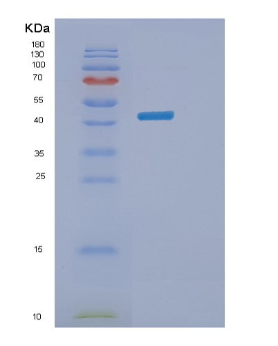 SDS-PAGE analysis of Human CSNK2A1 (Casein Kinase Ii Subunit Alpha) - Recombinant Protein, CAT# BLT-08392P showing >90% purity under 15% SDS-PAGE (Reduced)