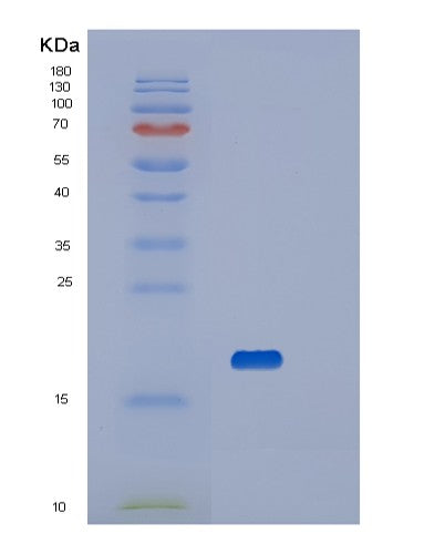 SDS-PAGE analysis of Human VSIR (V-Type Immunoglobulin Domain-Containing Suppressor Of T-Cell Activation) - Recombinant Protein, showing >85% purity under 15% SDS-PAGE (Reduced)