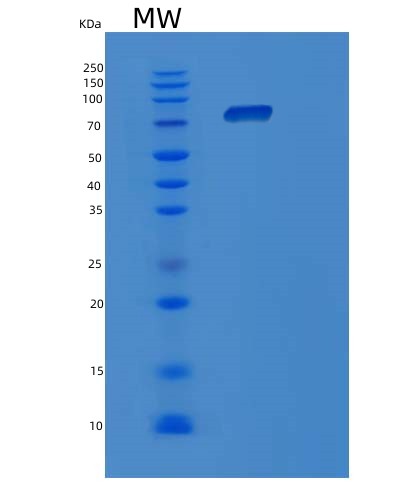 SDS-PAGE analysis of Human POR (Nadph--Cytochrome P450 Reductase) - Recombinant Protein, showing >90% purity under 15% SDS-PAGE (Reduced)