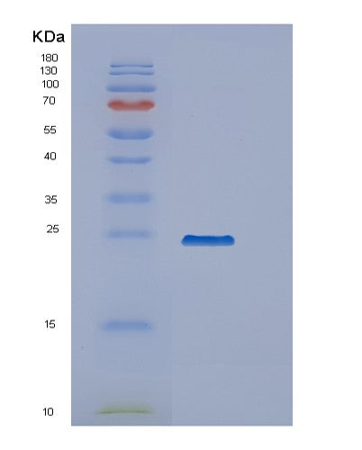 SDS-PAGE analysis of Human PPCDC (Phosphopantothenoylcysteine Decarboxylase) - Recombinant Protein, showing >95% purity under 15% SDS-PAGE (Reduced)