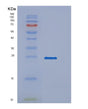 SDS-PAGE analysis of Human PPCDC (Phosphopantothenoylcysteine Decarboxylase) - Recombinant Protein, showing >95% purity under 15% SDS-PAGE (Reduced)