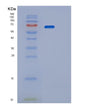 SDS-PAGE analysis of Human PPP2R1A (Serine/Threonine-Protein Phosphatase 2A 65 Kda Regulatory Subunit A Alpha Isoform) - Recombinant Protein, showing >95% purity under 15% SDS-PAGE (Reduced)