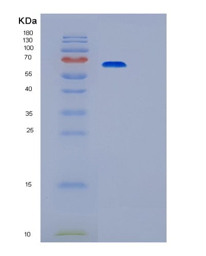 SDS-PAGE analysis of Human PRKACA (Camp-Dependent Protein Kinase Catalytic Subunit Alpha) - Recombinant Protein, showing >90% purity under 15% SDS-PAGE (Reduced)