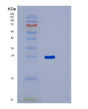 SDS-PAGE analysis of Human RAB1B (Ras-Related Protein Rab-1B) - Recombinant Protein, showing >90% purity under 15% SDS-PAGE (Reduced)