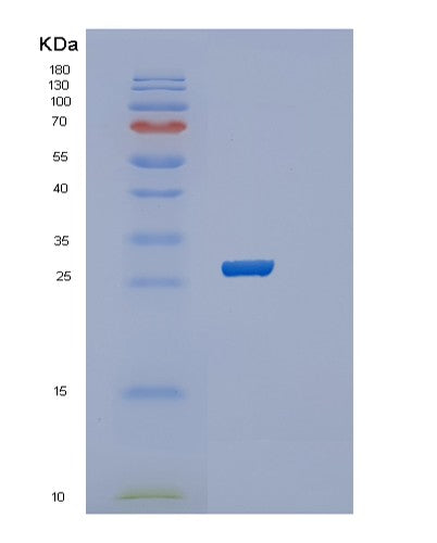 SDS-PAGE analysis of Human RAB39B (Ras-Related Protein Rab-39B) - Recombinant Protein, showing >85% purity under 15% SDS-PAGE (Reduced)