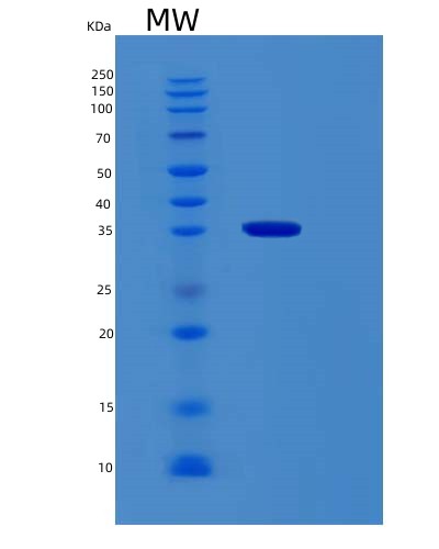SDS-PAGE analysis of Human RBM11 (Splicing Regulator Rbm11) - Recombinant Protein, showing >95% purity under 15% SDS-PAGE (Reduced)