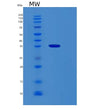 SDS-PAGE analysis of Human RBM11 (Splicing Regulator Rbm11) - Recombinant Protein, showing >95% purity under 15% SDS-PAGE (Reduced)