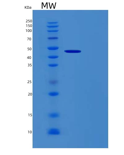 SDS-PAGE analysis of Human RBM17 (Splicing Factor 45) - Recombinant Protein, showing >90% purity under 15% SDS-PAGE (Reduced)