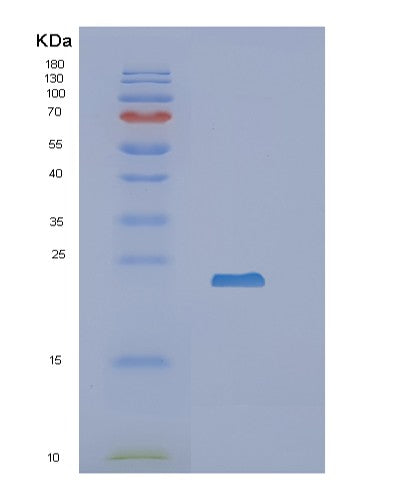 SDS-PAGE analysis of Human RBP4 (Retinol-Binding Protein 4) - Recombinant Protein, showing >90% purity under 15% SDS-PAGE (Reduced)