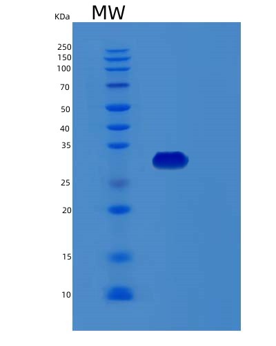 SDS-PAGE analysis of Human RCHY1 (Ring Finger And Chy Zinc Finger Domain-Containing Protein 1) - Recombinant Protein, showing >95% purity under 15% SDS-PAGE (Reduced)