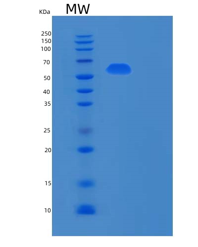 SDS-PAGE analysis of Human RPN2 (Dolichyl-Diphosphooligosaccharide--Protein Glycosyltransferase Subunit 2) - Recombinant Protein, showing >85% purity under 15% SDS-PAGE (Reduced)
