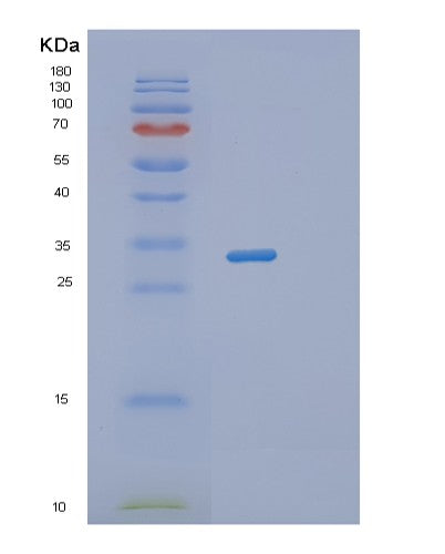 SDS-PAGE analysis of Human RWDD1 (Rwd Domain-Containing Protein 1) - Recombinant Protein, showing >95% purity under 15% SDS-PAGE (Reduced)