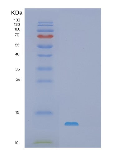 SDS-PAGE analysis of Mouse S100a1 (Protein S100-A1) - Recombinant Protein, showing >90% purity under 15% SDS-PAGE (Reduced)