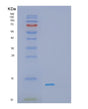SDS-PAGE analysis of Human S100A10 (Protein S100-A10) - Recombinant Protein, showing >85% purity under 15% SDS-PAGE (Reduced)