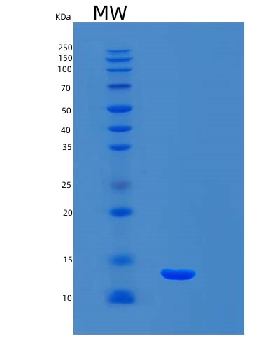 SDS-PAGE analysis of Mouse S100a5 (Protein S100-A5) - Recombinant Protein, showing >85% purity under 15% SDS-PAGE (Reduced)