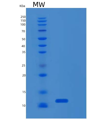 SDS-PAGE analysis of Mouse S100b (Protein S100-B) - Recombinant Protein, showing >85% purity under 15% SDS-PAGE (Reduced)