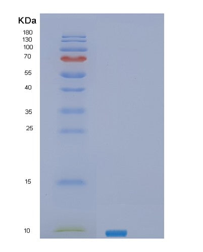 SDS-PAGE analysis of Human SEC61B (Protein Transport Protein Sec61 Subunit Beta) - Recombinant Protein, showing >95% purity under 15% SDS-PAGE (Reduced)