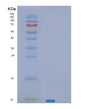 SDS-PAGE analysis of Human SEC61B (Protein Transport Protein Sec61 Subunit Beta) - Recombinant Protein, showing >95% purity under 15% SDS-PAGE (Reduced)