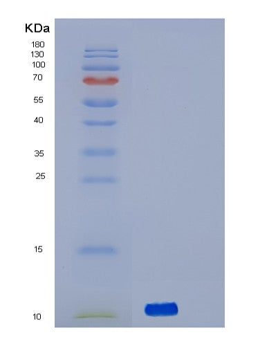 SDS-PAGE analysis of Human ACVRL1 (Activin Receptor Type-1-Like) - Recombinant Protein, showing >90% purity under 15% SDS-PAGE (Reduced)