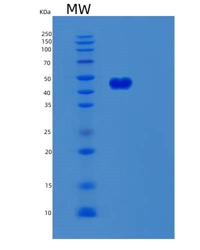 SDS-PAGE analysis of Human SERPINB8 (Serpin B8) - Recombinant Protein, showing >90% purity under 15% SDS-PAGE (Reduced)