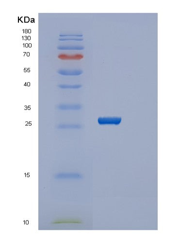SDS-PAGE analysis of Human SERTAD1 (Serta Domain-Containing Protein 1) - Recombinant Protein, showing >95% purity under 15% SDS-PAGE (Reduced)