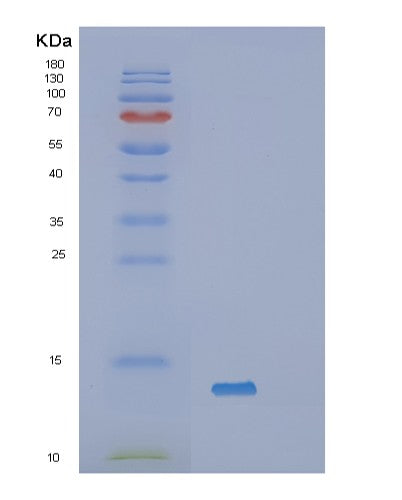 SDS-PAGE analysis of Human SAA1 (Serum Amyloid A-1 Protein) - Recombinant Protein, showing >85% purity under 15% SDS-PAGE (Reduced)