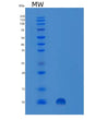 SDS-PAGE analysis of Human SPINK7 (Serine Protease Inhibitor Kazal-Type 7) - Recombinant Protein, showing >85% purity under 15% SDS-PAGE (Reduced)