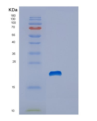SDS-PAGE analysis of Human STMN1 (Stathmin) - Recombinant Protein, showing >90% purity under 15% SDS-PAGE (Reduced)