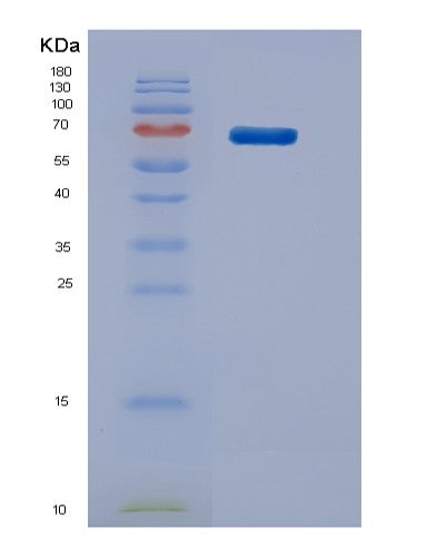 SDS-PAGE analysis of Mouse Stip1 (Stress-Induced-Phosphoprotein 1) - Recombinant Protein, showing >85% purity under 15% SDS-PAGE (Reduced)