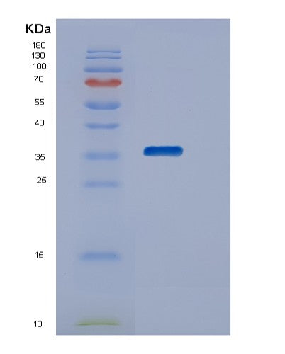 SDS-PAGE analysis of Human STK16 (Serine/Threonine-Protein Kinase 16) - Recombinant Protein, showing >90% purity under 15% SDS-PAGE (Reduced)