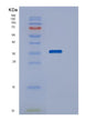 SDS-PAGE analysis of Human STK16 (Serine/Threonine-Protein Kinase 16) - Recombinant Protein, showing >90% purity under 15% SDS-PAGE (Reduced)
