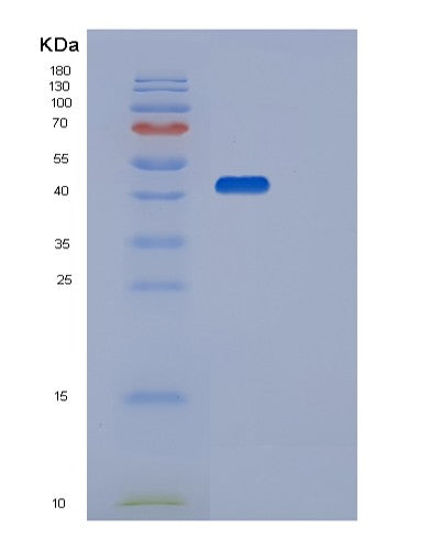 SDS-PAGE analysis of Human STK17B (Serine/Threonine-Protein Kinase 17B) - Recombinant Protein, showing >95% purity under 15% SDS-PAGE (Reduced)