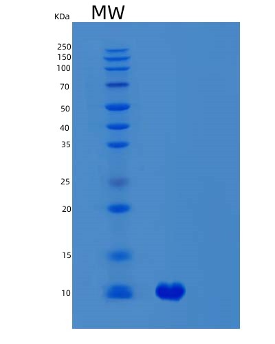SDS-PAGE analysis of Human SVIP (Small Vcp/P97-Interacting Protein) - Recombinant Protein, showing >95% purity under 15% SDS-PAGE (Reduced)