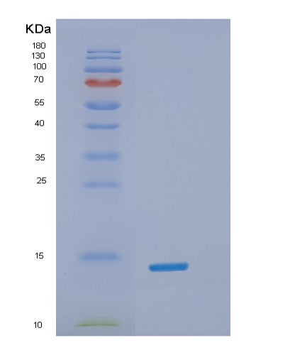 SDS-PAGE analysis of Human SNCA (Alpha-Synuclein) - Recombinant Protein, showing >95% purity under 15% SDS-PAGE (Reduced)