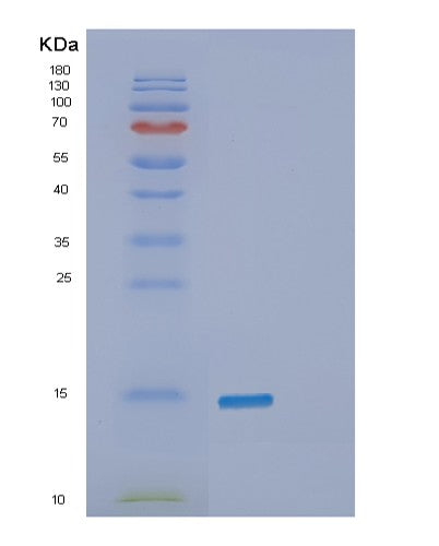 SDS-PAGE analysis of Human SNCB (Beta-Synuclein) - Recombinant Protein, showing >90% purity under 15% SDS-PAGE (Reduced)