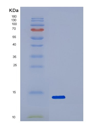 SDS-PAGE analysis of Human SNCA (Alpha-Synuclein) - Recombinant Protein, showing >95% purity under 15% SDS-PAGE (Reduced)