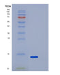SDS-PAGE analysis of Human SNCA (Alpha-Synuclein) - Recombinant Protein, showing >95% purity under 15% SDS-PAGE (Reduced)