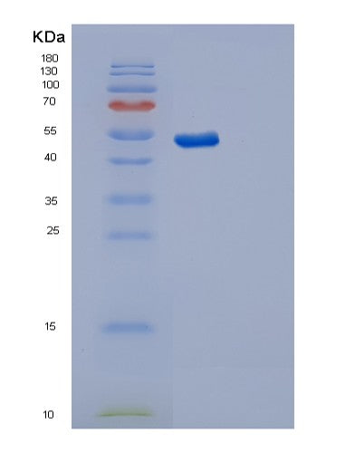 SDS-PAGE analysis of Human SYT11 (Synaptotagmin-11) - Recombinant Protein, showing >85% purity under 15% SDS-PAGE (Reduced)